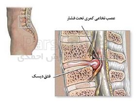 6 دشمن ستون فقرات