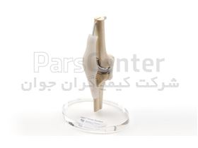 مولاژ زانو با ابزار ایمپلنت (مولاژ مفصل زانو) با قابلیت کار گزاری ایمپلنت
