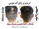 خدمات میکرو اسکالپ