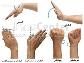 علل درد مچ دست