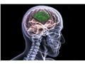 ایمپلنت مغزی چیست و چگونه از طریق آن میتوان حافظه انسان را افزایش داد؟