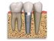 DENTAL IMPLANT