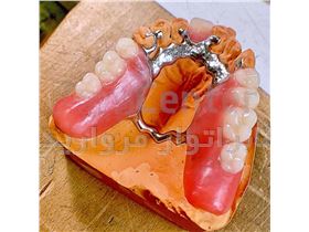 سازنده دندان مصنوعی