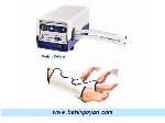 پمپ DVT (پیشگیری از آمبولی ریوی)