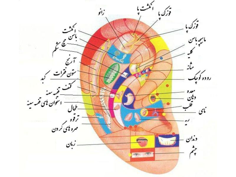 طب سوزنی دکتر پرچمی